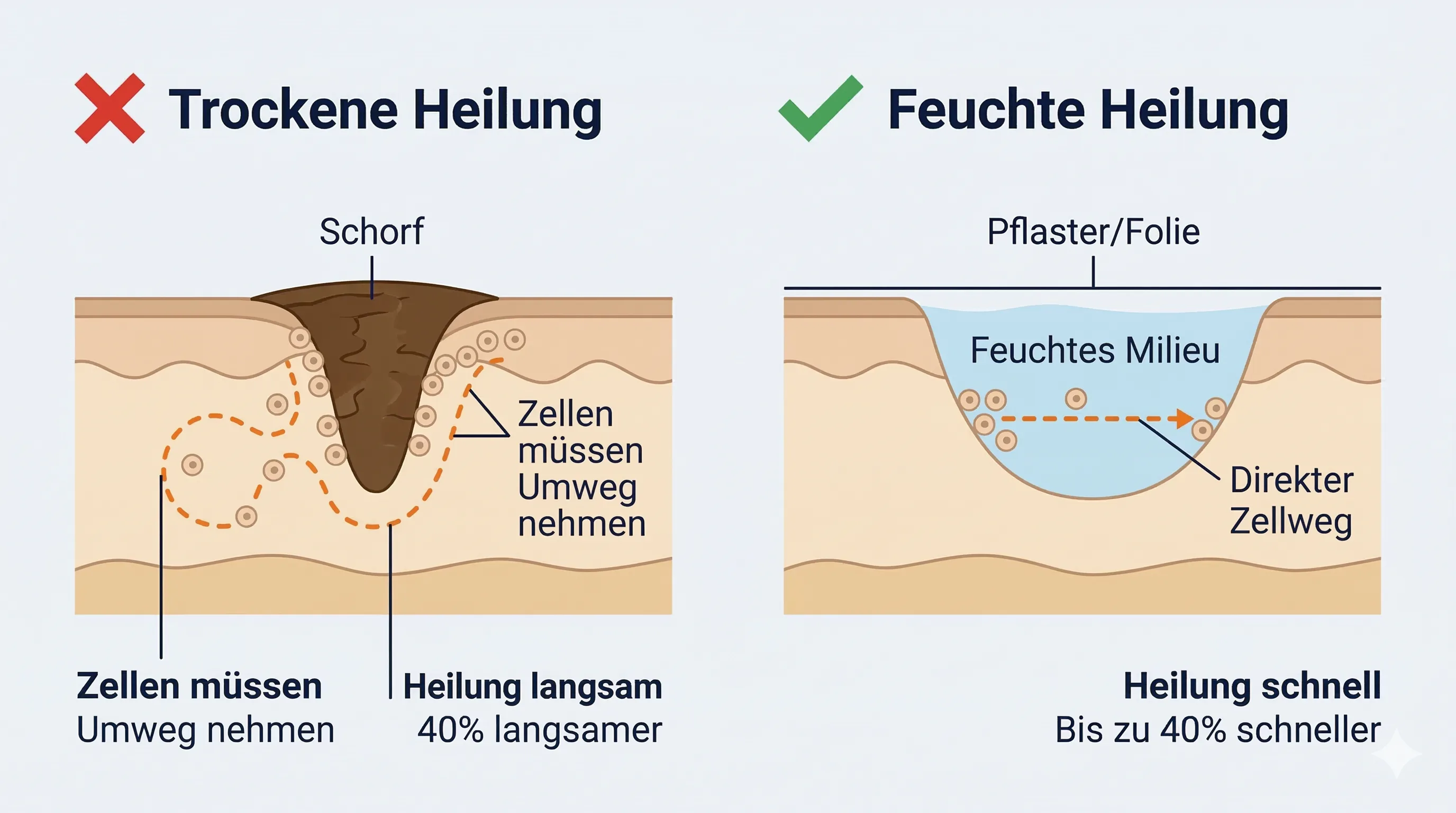 Feuchte vs. trockene Wundheilung im Vergleich: Unter Pflaster heilen Zellen schneller auf direktem Weg, an der Luft müssen sie unter dem Schorf wandern