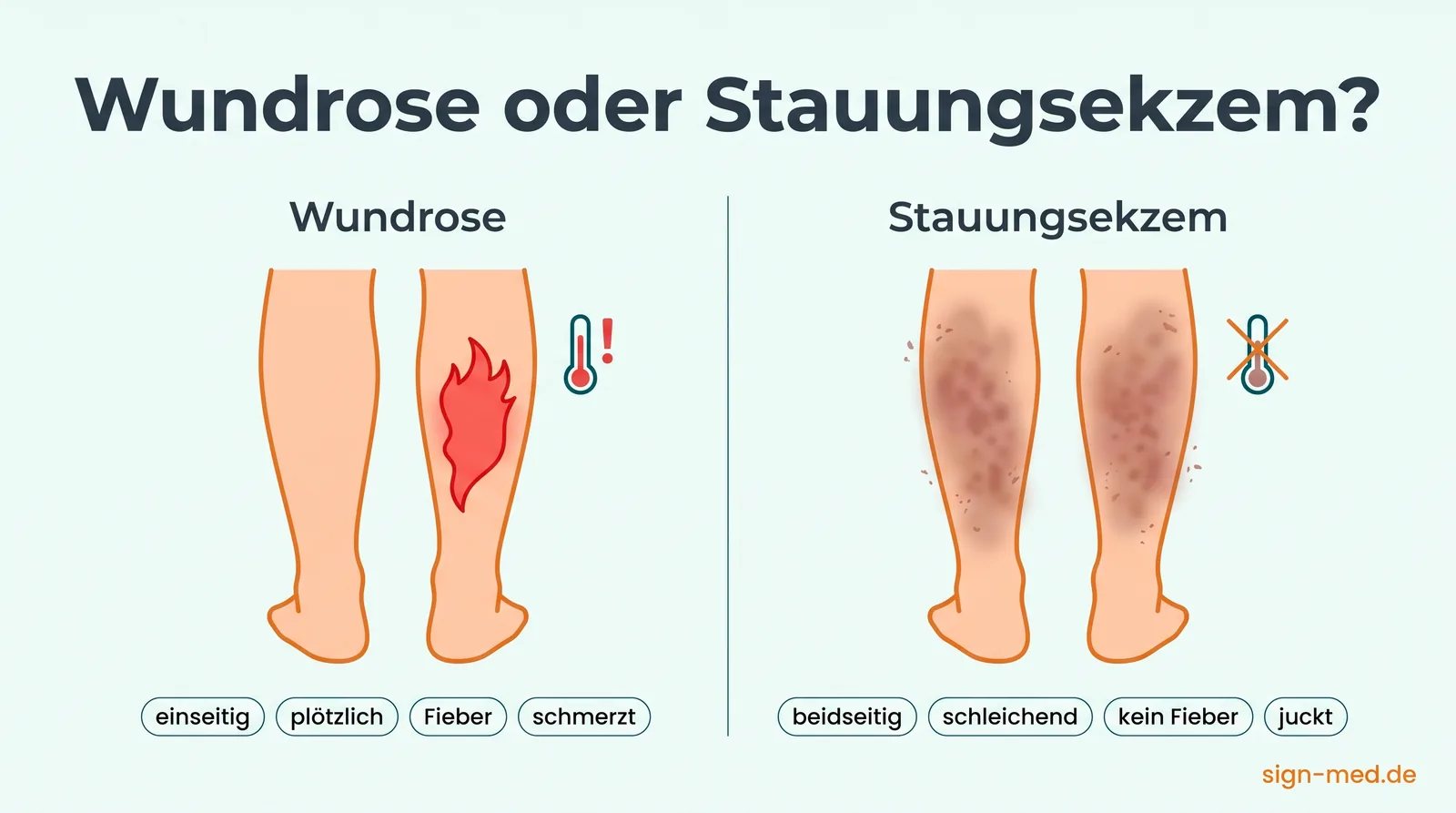 Vergleichsgrafik: Wundrose betrifft ein Bein mit scharf begrenzter roter Entzündung und Fieber — das Stauungsekzem beide Beine mit diffuser, bräunlicher, juckender Rötung ohne Fieber